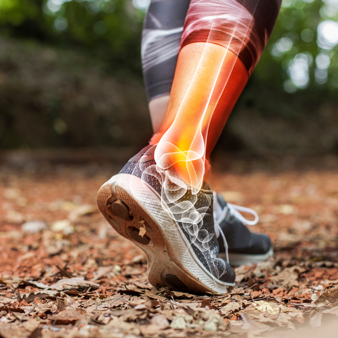 Sports Injury